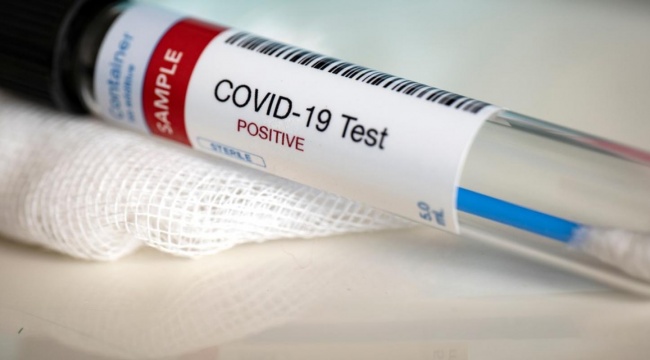 Son 24 saatin virüs tablosu: Vaka sayısı 6 bin sınırında