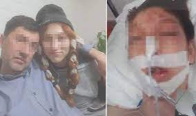 Cinsel istismara kalkıştığı kızı ağır yaraladı