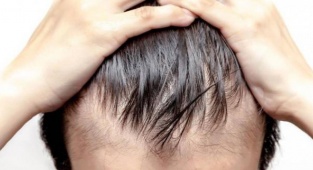 Stres Saç Sağlığını Tehdit Ediyor