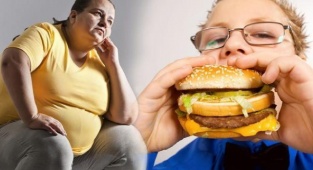 Kayseri Kızılay Hastanesi “Obezite Cerrahisi” Tedavisine Başladı