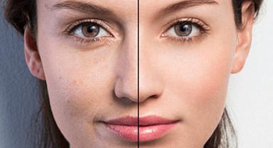 Işıltılı bir cilt için 12 pratik yöntem!