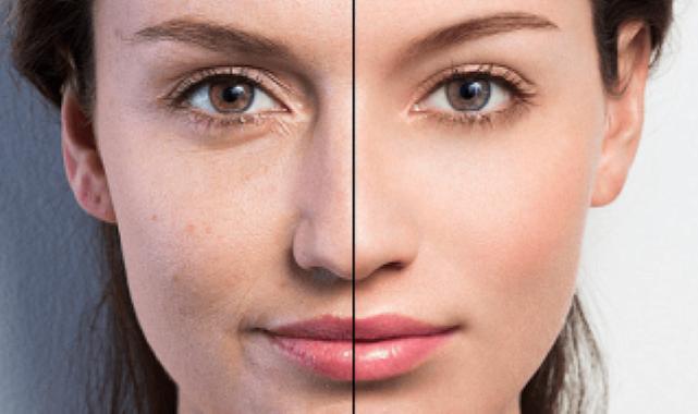 Işıltılı bir cilt için 12 pratik yöntem!