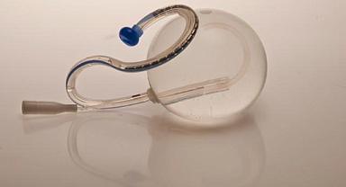 Mide balonu ile ilgili merak edilen 5 soru