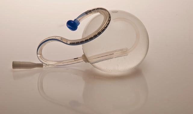 Mide balonu ile ilgili merak edilen 5 soru