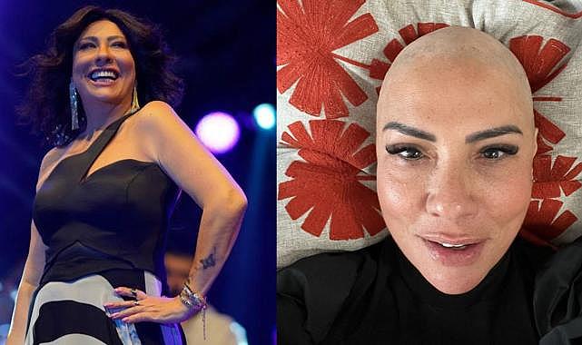 Işın Karaca yakalandığı hastalığı sosyal medyadan duyurdu