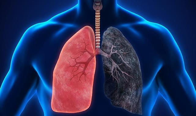 Kronik Akciğer Hastalığı Olanlar Yaz Aylarında Nelere Dikkat Etmeli?