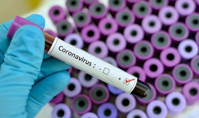 Covid-19 hortladı: Eris varyantı için uzmanlar Eylül ayına dikkat çekti