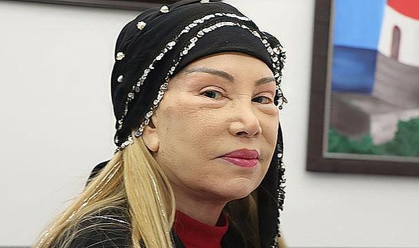 Estetik yaptıran 81 yaşındaki Bedia Akartürk yeni imajı ile görüntülendi