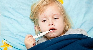 Kızamık salgınına karşı aşı uyarısı!