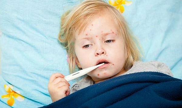 Kızamık salgınına karşı aşı uyarısı!