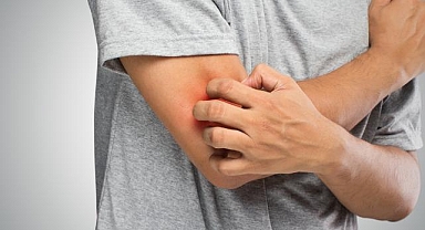 Mantar hastalığının en sık görülen belirtileri!