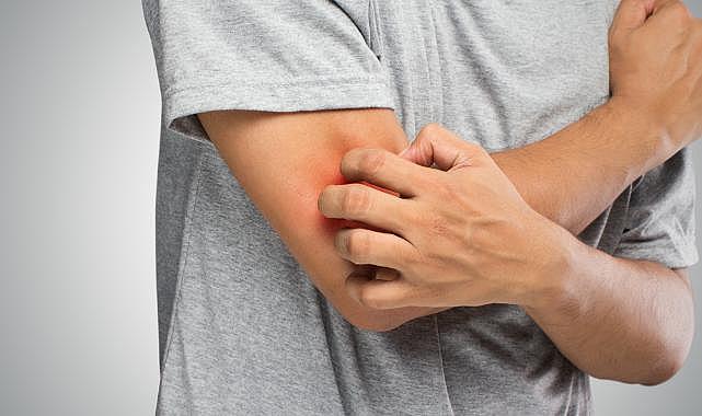 Mantar hastalığının en sık görülen belirtileri!