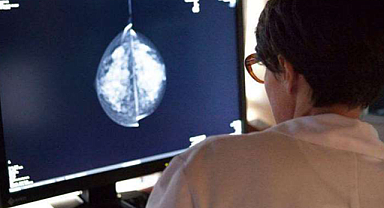 Yapay zeka meme kanseri tespitinde başarılı oldu