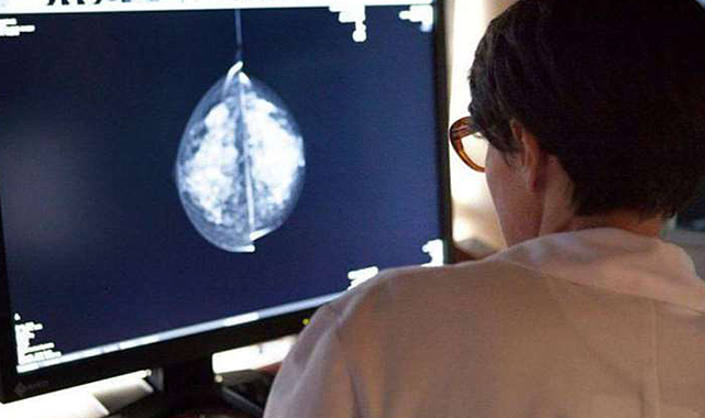 Yapay zeka meme kanseri tespitinde başarılı oldu