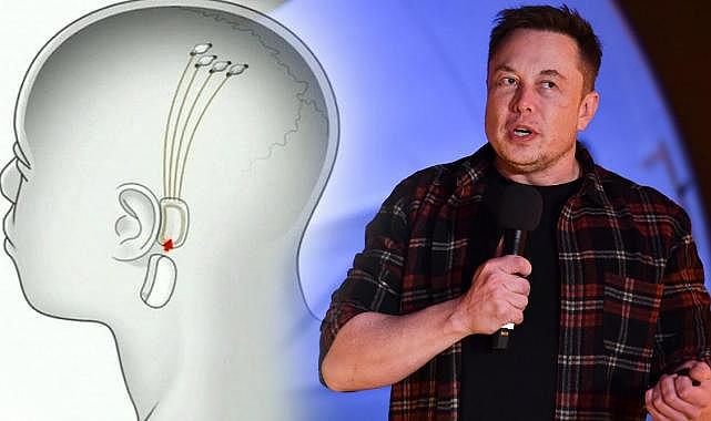 Elon Musk&#039;ın şirketi Neuralink onay aldı: Beyin çipi deneyleri başlıyor