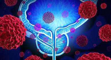 Prostat kanserinde hayat kurtaran 4 öneri