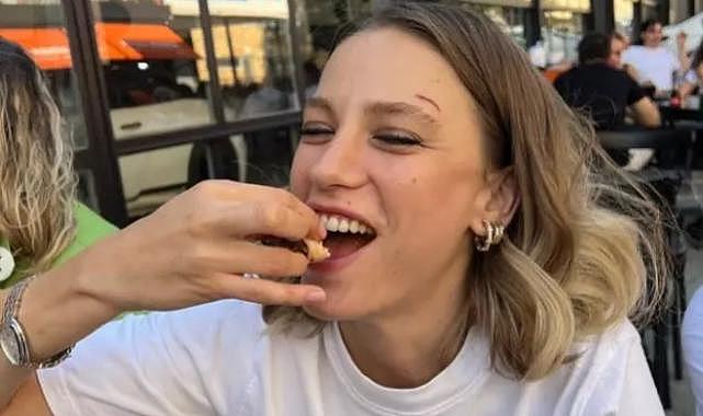 Serenay Sarıkaya hayranlarını korkuttu! &#039;&#039;Kaşımdaki yara...&#039;&#039;