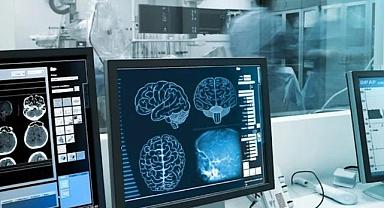 Beyin tümörünü tespit edecek… COVID testi gibi basit ve pratik