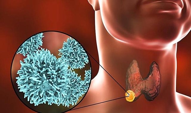 İçindeki sese kulak verdi sağlığına kavuştu! Doktorlar bile şaşırdı &#039;Litratürde bu kadar büyüğünü görmedim&#039;