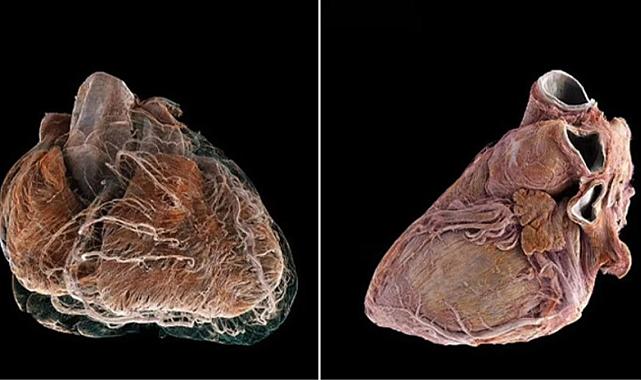 Bilim insanları, insan kalbinin iç yapısını ayrıntılı olarak gösteren, Google Earth'e benzer yeni bir teknoloji geliştirdi