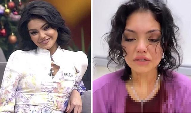 Kısmetse Olur yarışmacısı Eslem Sena Nur, 3 kadının saldırısına uğradı! Kafasına çakı sokup merdivenden ittiler