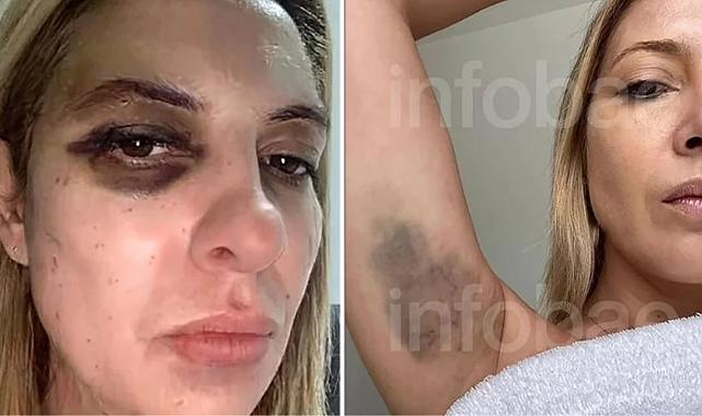 Arjantin eski devlet başkanı Alberto Fernandez, şiddet uyguladığı eşini hastanelik etti