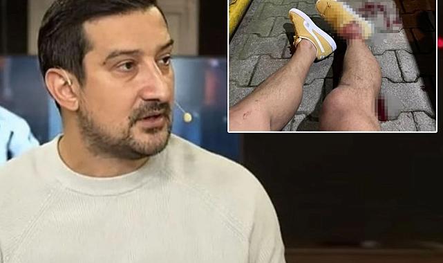 İçişleri Bakanı Yerlikaya, eski futbolcu Serhat Akın&#039;a saldıran şüphelilerin yakalandığını açıkladı