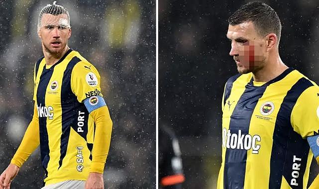 Edin Dzeko&#039;nun kafasını yaran futbolcu sessizliğini bozdu