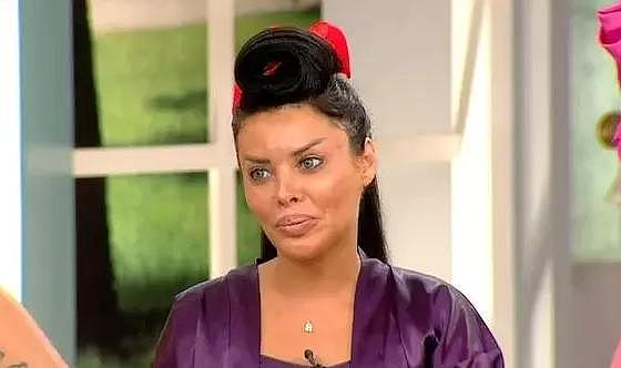 Estetik bağımlısı fenomenin canlı yayında göğsündeki silikonları patladı