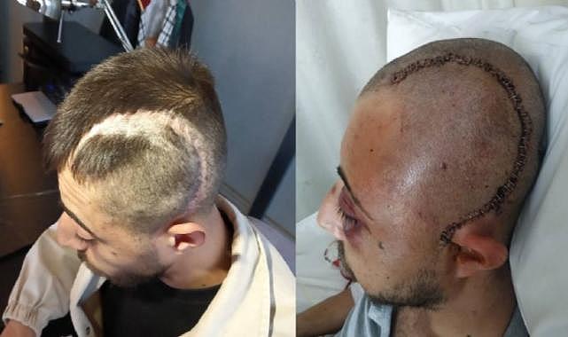 Patronunun öldüresiye darp ettiği çalışan yüzde 32 fiziksel engelli kaldı