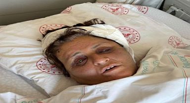 Yufka yüzünden gelini tarafından tuğlayla dövülüp komalık olmuştu, günler sonra uyandı