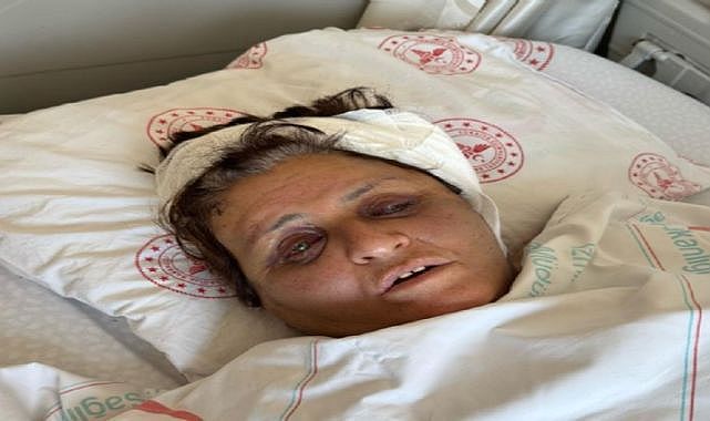 Yufka yüzünden gelini tarafından tuğlayla dövülüp komalık olmuştu, günler sonra uyandı