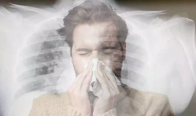 Çok nadir bir vaka: Hapşırmadı soluk borusu yırtıldı! Saman nezlesi olan adam, hapşırmasını tutunca hastanelik oldu...