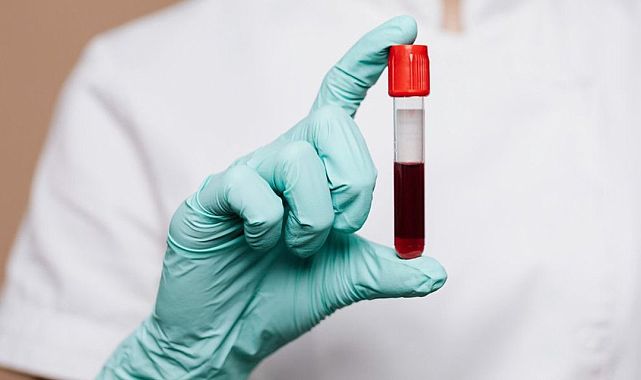 Bilim dünyasında dev keşif: 48. kan grubu