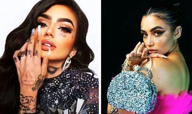 Estetik faciası: Ünlü fenomen hayatını kaybetti