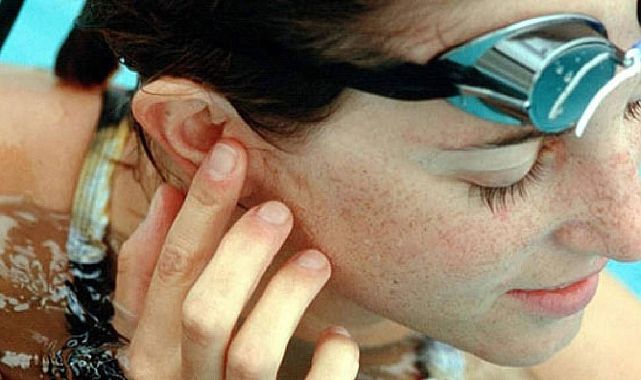 Havuz Keyfi Ağrıya Dönüşmesin: Kulak Burun Boğaz Uzmanından Önemli Uyarılar