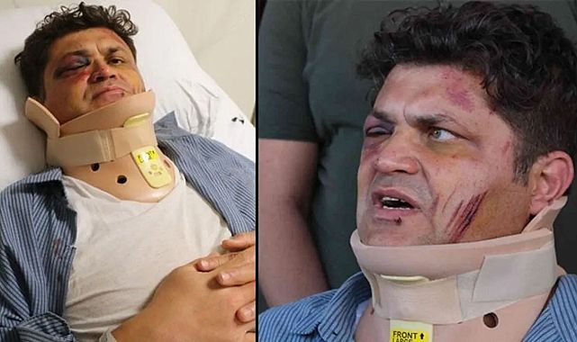 Torbalı&#039;da Doktora Şiddete 5 Yıl Hapis Cezası İstinaftan Döndü