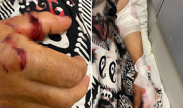 Bahçede abdest alırken köpek saldırısına uğradı