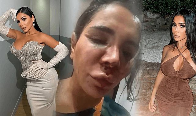 Çamaşır suyu detayıyla sarsan saldırı