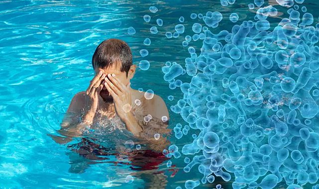 Havuzdan sonra hastane! Yaz enfeksiyonları patladı