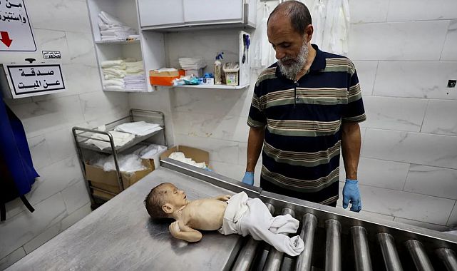İsrail ablukasında Gazze’de açlıktan ölümler devam ediyor
