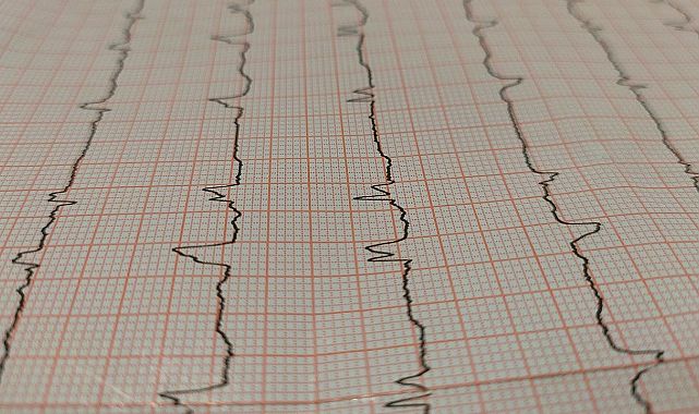 Kalp krizi sanılıyor, stres kaynaklı çıkıyor