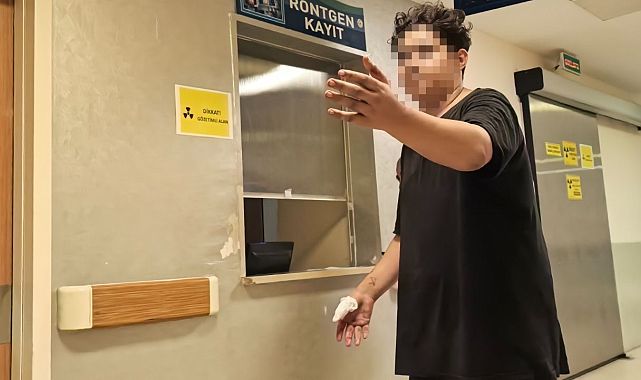 Motosiklet zincirine elini kaptıran çocuğun parmağı koptu