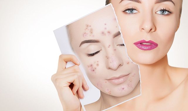 Sıcak havada makyaj cildi tehdit ediyor