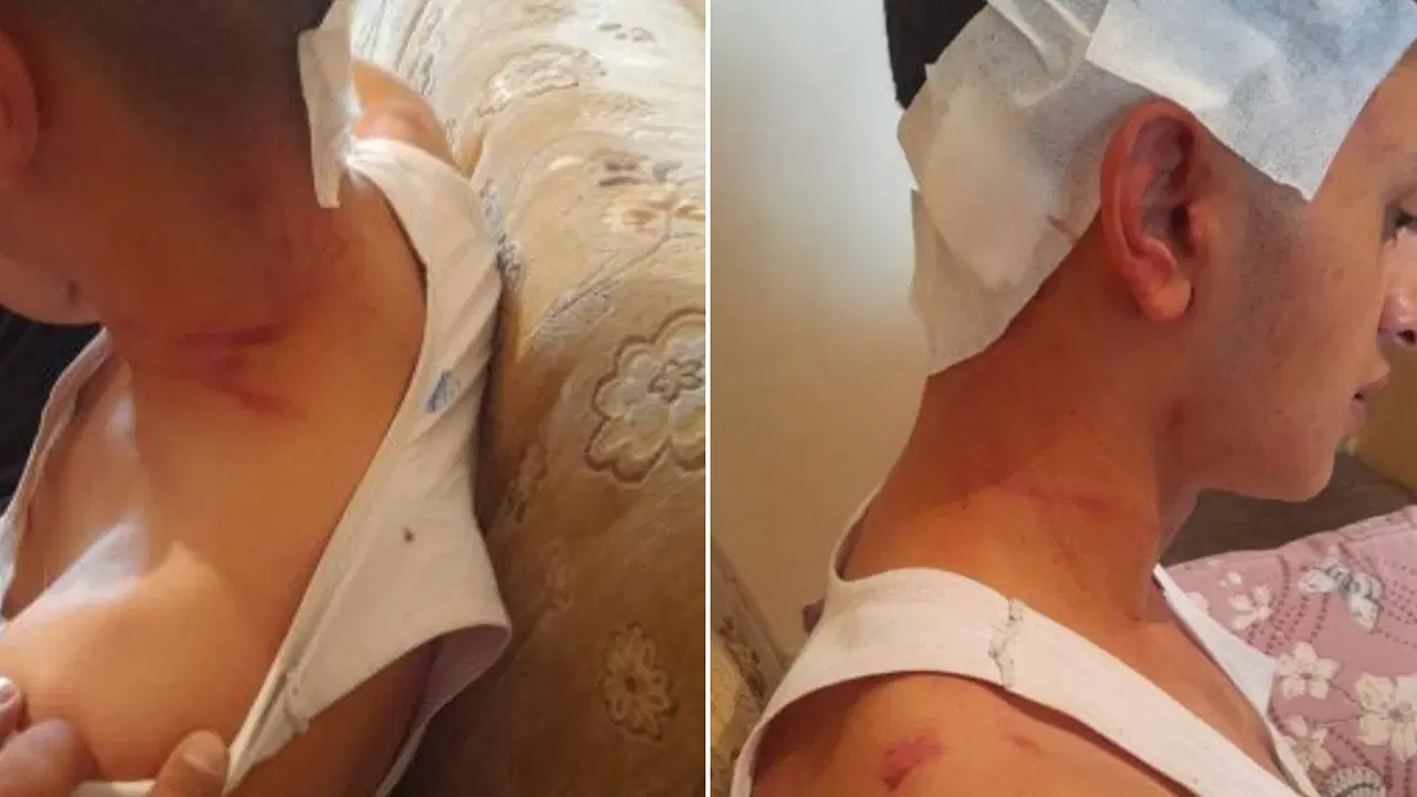 MHP’li başkanın oğulları hakkında darp iddiası!