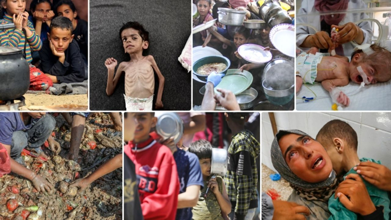 Açlık krizinde Gazze’de 115 çocuk hayatını kaybetti