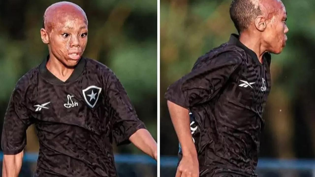 İnanılmaz bir başarı öyküsü! &quot;Yaşaması bile mucize&quot; deniyordu, şimdi fırtına gibi esiyor