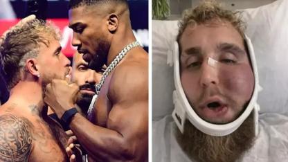 Suratı tanınmaz hale gelen Jake Paul'un ne kadar kazandığını duyunca şok olacaksınız