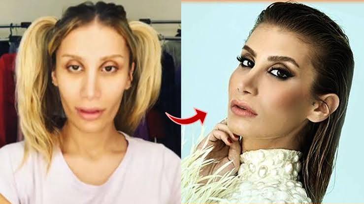 Estetikle Değişimleri Olay Oldu: İşte Görünümleriyle Gündemden Düşmeyen 10 Türk Ünlü